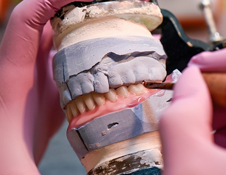 Dentures are made with a unique, multi-step process