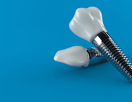 Closeup of dental implants